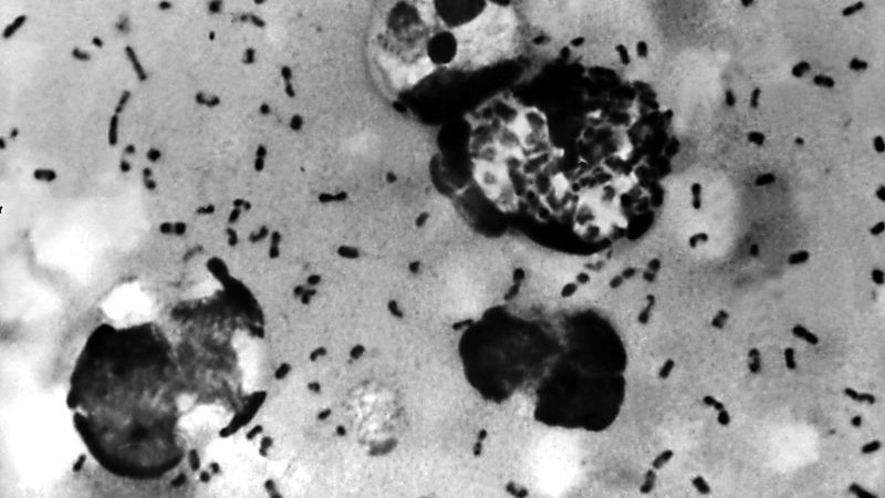 Alerta sanitaria internacional: Fallecimiento de científica en Rusia reaviva las alarmas sobre la peste neumónica