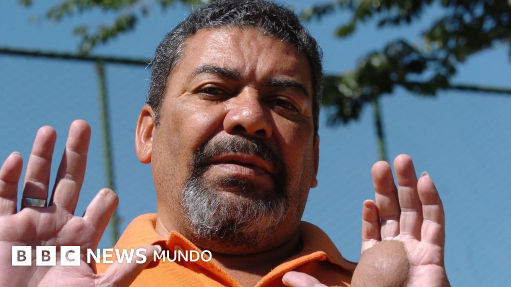 La tragedia del cesio-137 en Brasil: el resplandor mortal que devastó a una familia y marcó la historia nuclear
